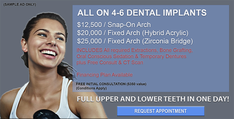 Sample of an incomplete dental implant ad not showing almost 50% of the total cost