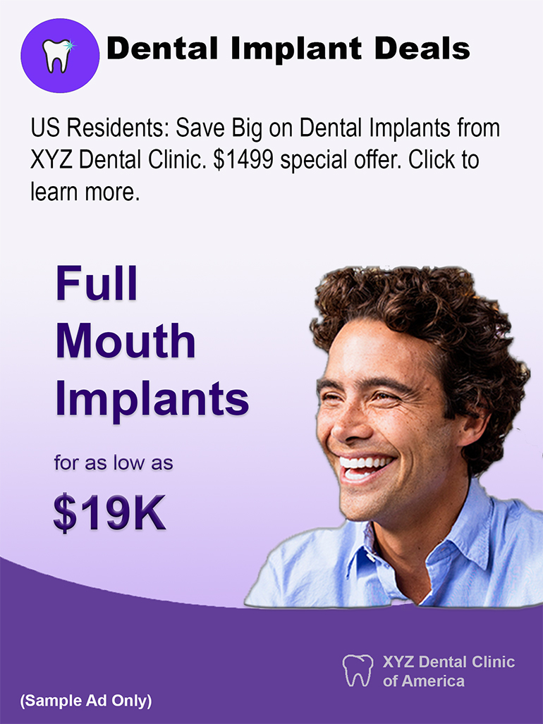 Sample dental implant ad that shows entry level pricing
