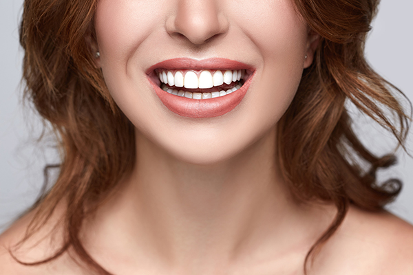 Chiclet-shaped porcelain veneers that look fake and noticeable
