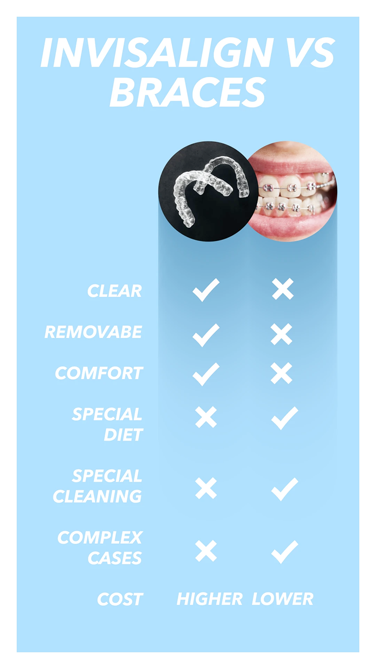 invisalign vs braces san diego - pros and cons of Invisalign
