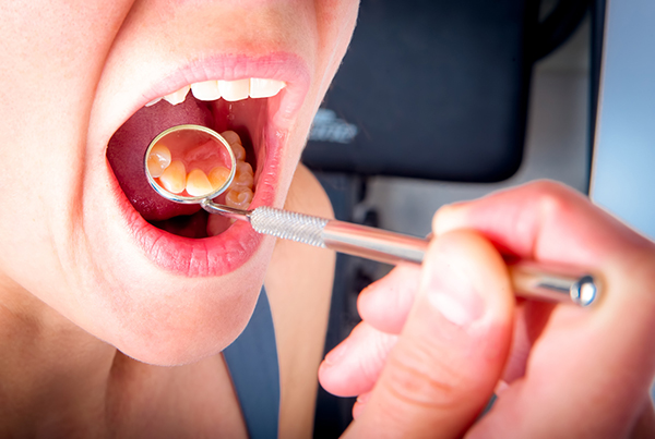 dental examination before full-mouth reconstruction