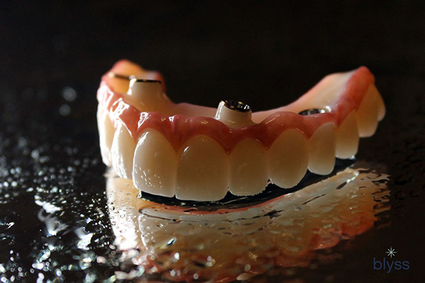 close-up of a snap-in denture