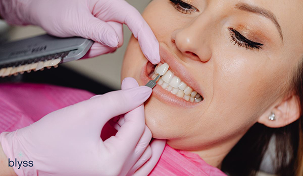 veneer being glued on patient's teeth