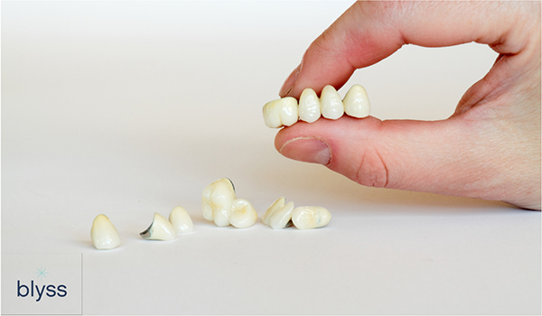 cosmetic dentistry - dental crowns and bridges