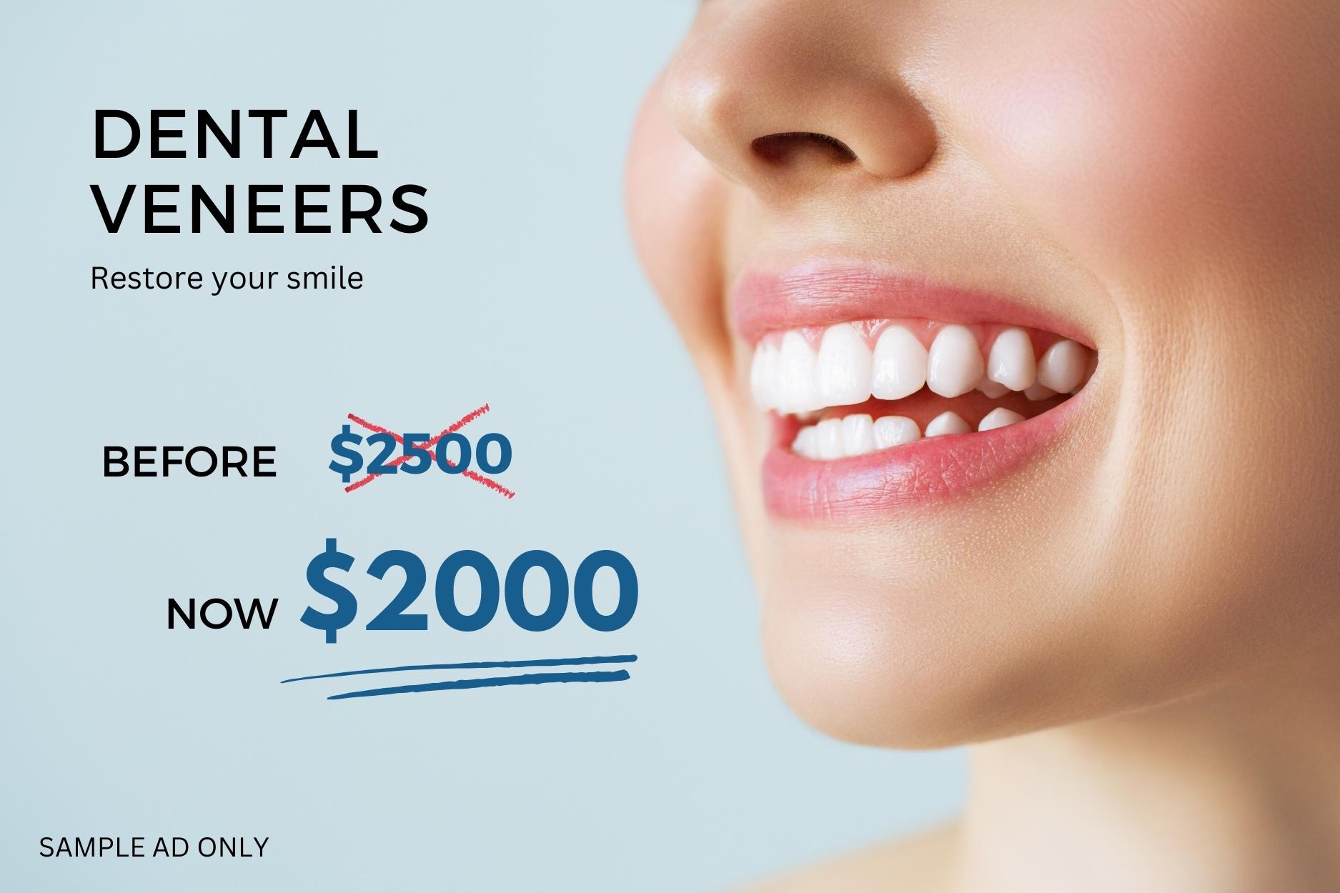 dental veneers sample ad with inflated price