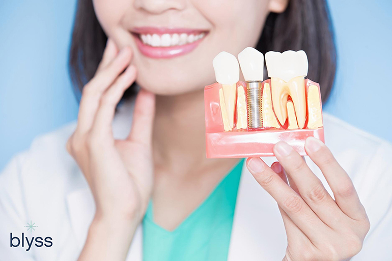 female dentist holding an implant model and touching jaw on blue background
