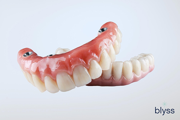 dental upper and lower jaw full mouth prosthesis 
