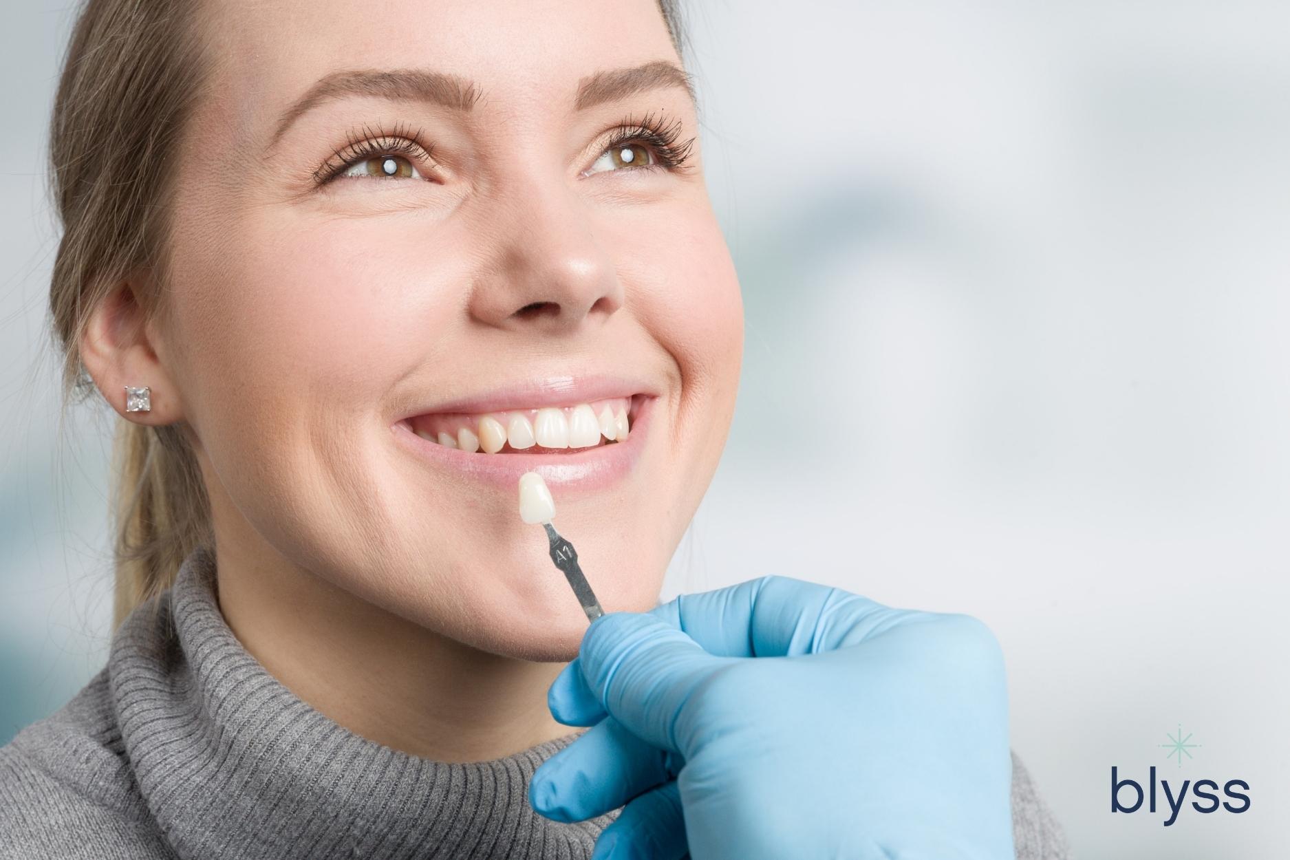 woman using shade guide at the mouth to check veneer of tooth