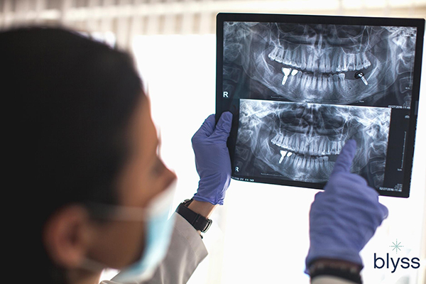 dentist showing x-ray results of dental implants