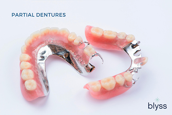 two removable partial dentures with metal framework