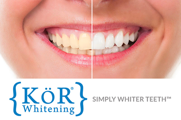 before and after teeth whitening with KöR Whitening logo