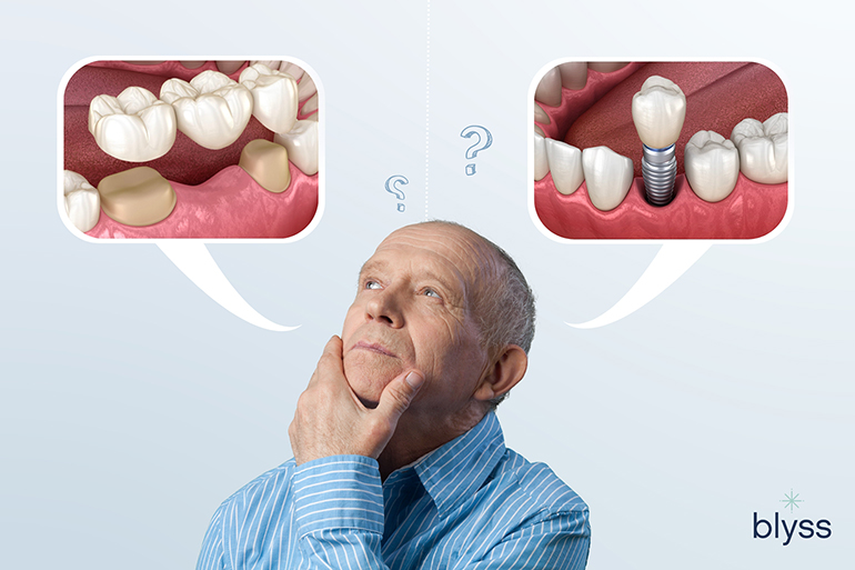 senior adult man thinking 3D illustration of dental bridge and dental implant